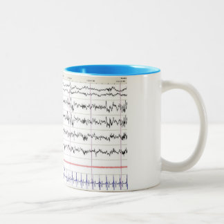 Sleep EEG Mug - Stage 2 Sleep