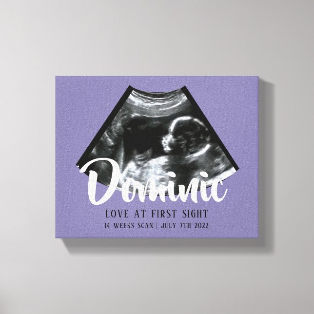 Sonogram Keepsake Baby Ultrasound Canvas Print (Front)