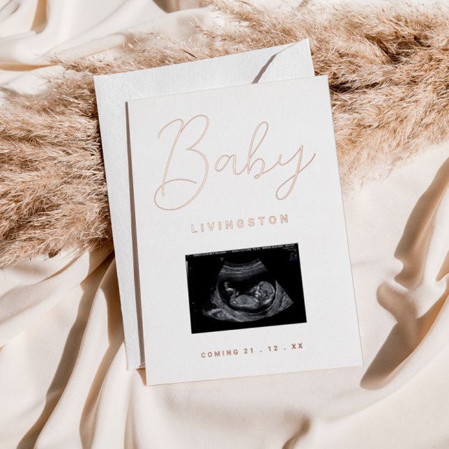 Sonogram Rose Gold Foil Pregnancy Announcement (Creator Uploaded)