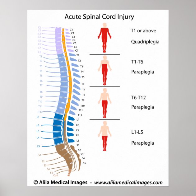 Spinal Cord Injury Levels, Labelled Diagram. Poster | Zazzle.co.nz