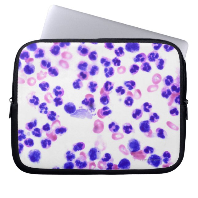 Staph Infection Laptop Sleeve (Front)