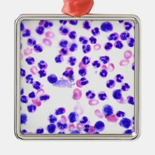 Staph Infection Metal Tree Decoration (Front)