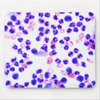 Staph Infection Mouse Pad