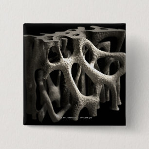 Structure of a bone with osteoporosis 15 cm square badge