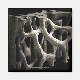 Structure of a bone with osteoporosis magnet