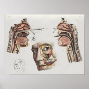 Surgery Medical Technique Vintage Anatomy Print