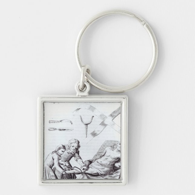 Surgical operation to amputate a leg key ring (Front)