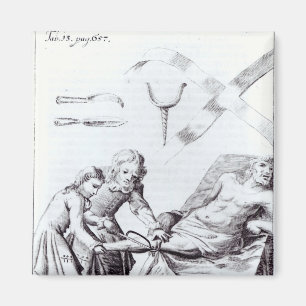 Surgical operation to amputate a leg magnet
