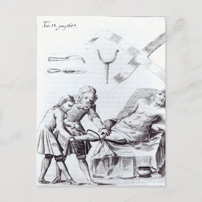 Surgical operation to amputate a leg postcard (Front)