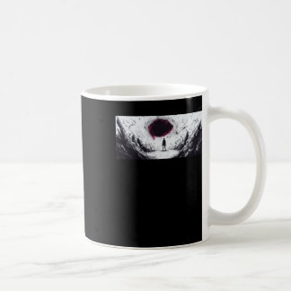 Swallowed 1 coffee mug
