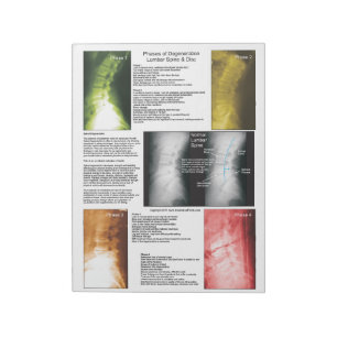 Tear Off Pad Lumbar Spinal Degeneration