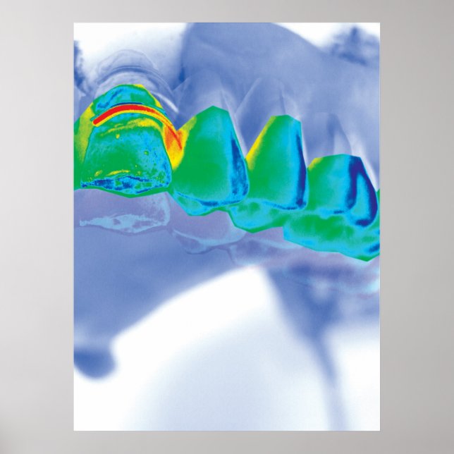 Teeth Design Dentist Orthodontist Poster (Front)
