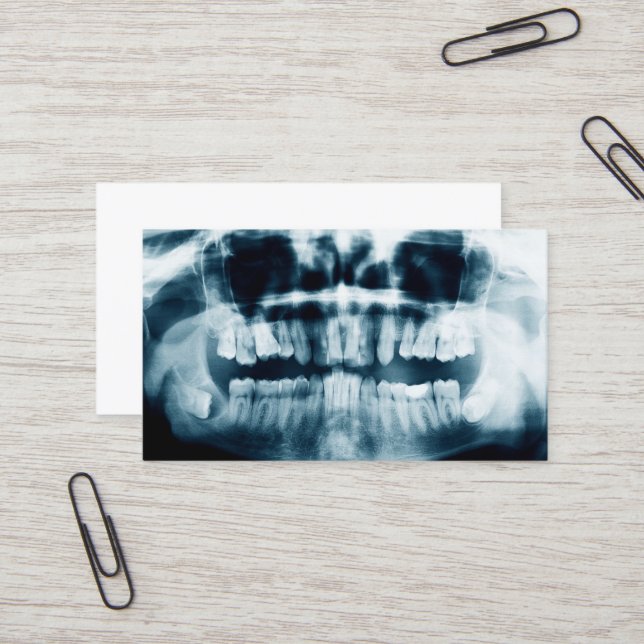 Teeth X-ray Business Card (Front/Back In Situ)