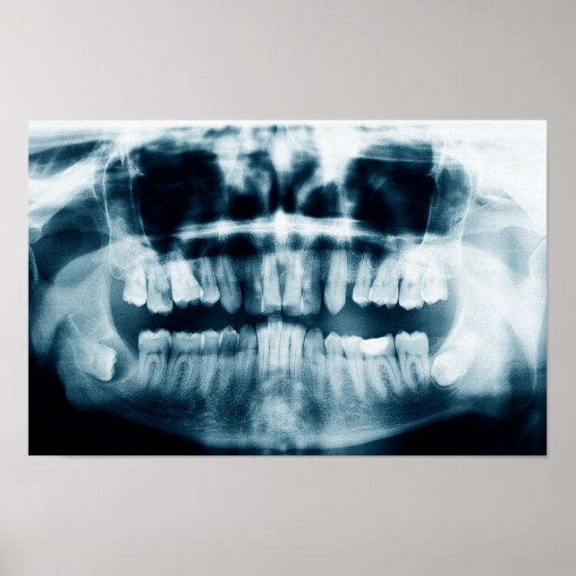 Teeth X-ray Poster (Front)