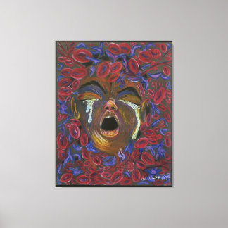 Ten Redefined - Sickle Cell Pain Awareness Canvas Print