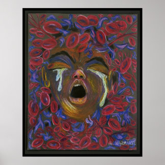 Ten Redefined - Sickle Cell Pain Awareness Print