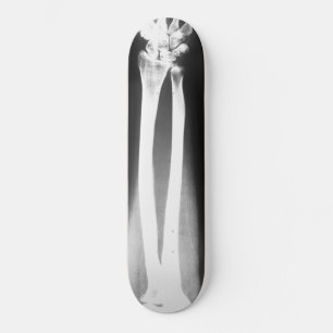 The Breaks skateboard by Bradley Boness