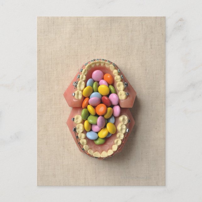 The chocolate served in the dental model postcard (Front)