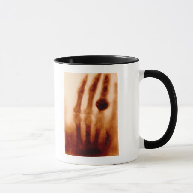 The First X-Ray, 1901, Photograph Mug (Right)