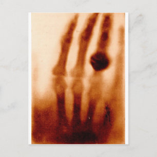 The First X-Ray, 1901, Photograph Postcard