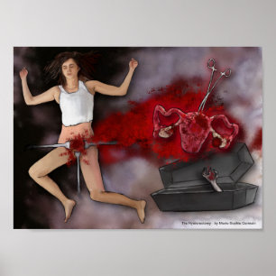The Hysterectomy Poster