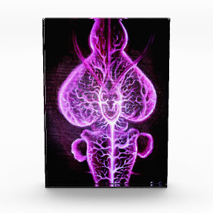 The vascularisation of the nervous system in roden photo block