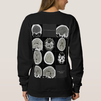 Thisiswhatdepressionlookslike_FULLCTScan Sweatshirt