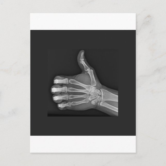 Thumbs up postcard (Front)
