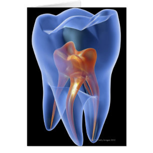 Tooth, transparent cross section of a molar