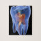 Tooth, transparent cross section of a molar