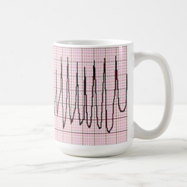 Torsades Coffee Mug (Right)