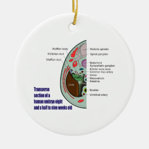 Transverse Section of Human Embryo 9 Weeks Old Ceramic Tree Decoration