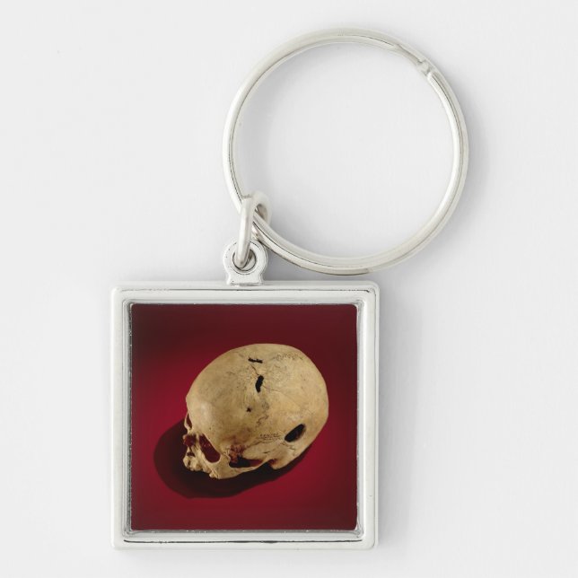 Trepanned Skull Key Ring (Front)