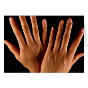 Two crossed hands