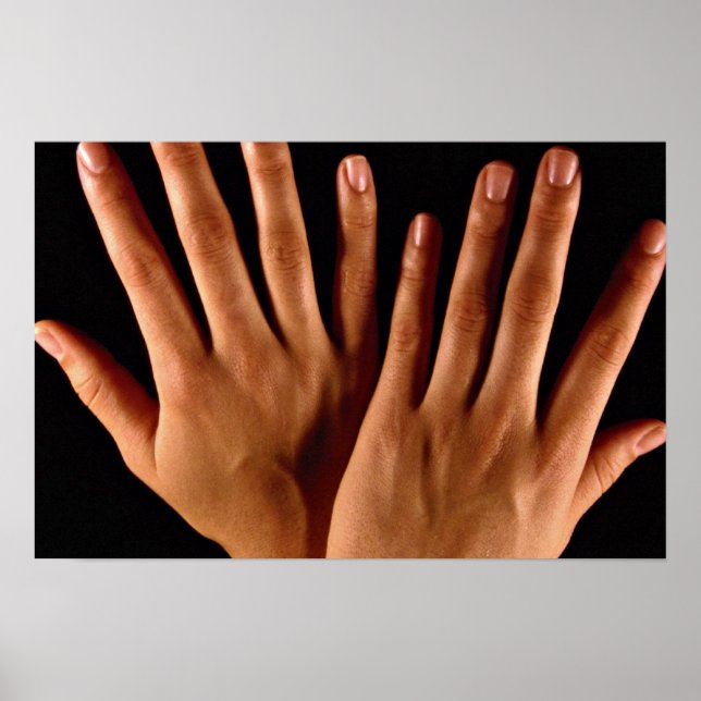 Two crossed hands poster (Front)