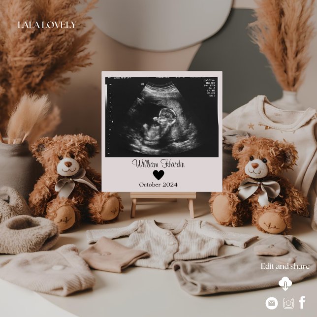 Two cute bears ultrasound pregnancy announcement (Creator Uploaded)