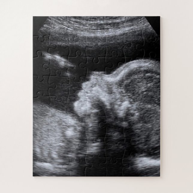 Ultrasound Photo Jigsaw Puzzle (Vertical)