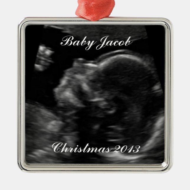 Ultrasound Photo Template Metal Tree Decoration (Front)