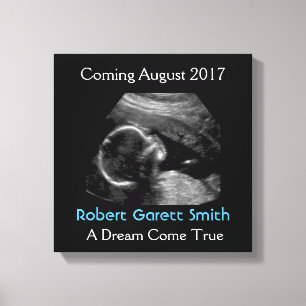 Ultrasound with Name & Picture Canvas Wall Hanging Print