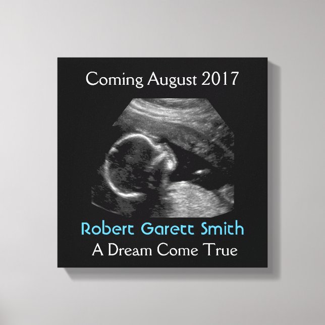 Ultrasound with Name & Picture Canvas Wall Hanging Print (Front)
