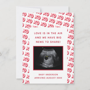 Valentine's Day Ultrasound Pregnancy Reveal  Announcement