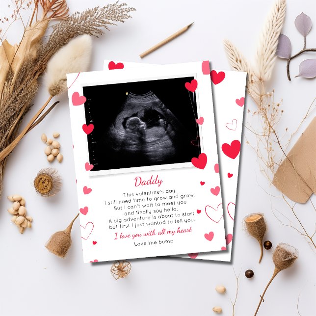 Valentines to Daddy From Bump (Creator Uploaded)