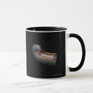 View of an angioplaty balloon in an artery mug