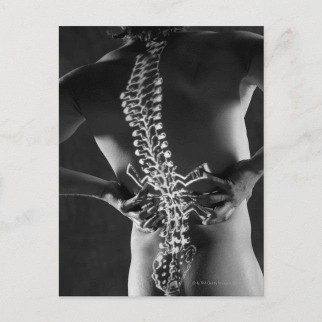 View of spinal chord postcard (Front)