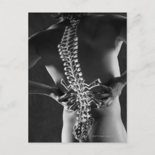 View of spinal chord postcard