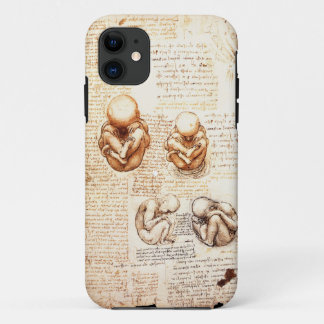 Views of a Foetus in the Womb,Ob-Gyn Medical Case-Mate iPhone Case