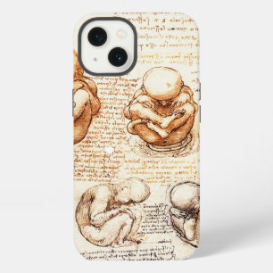 Views of a Foetus in the Womb,Ob-Gyn Medical iPhone 13 Case