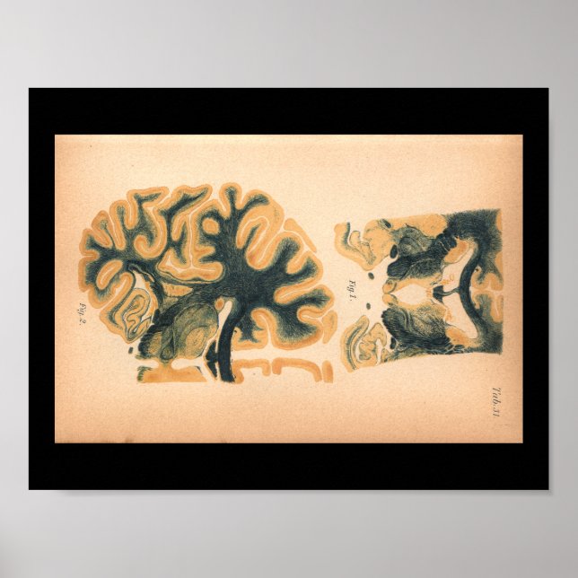 Vintage 1901 Brain Anatomy Print (Front)