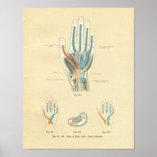 Vintage Frohse Anatomy of Hand & Tendons Poster
