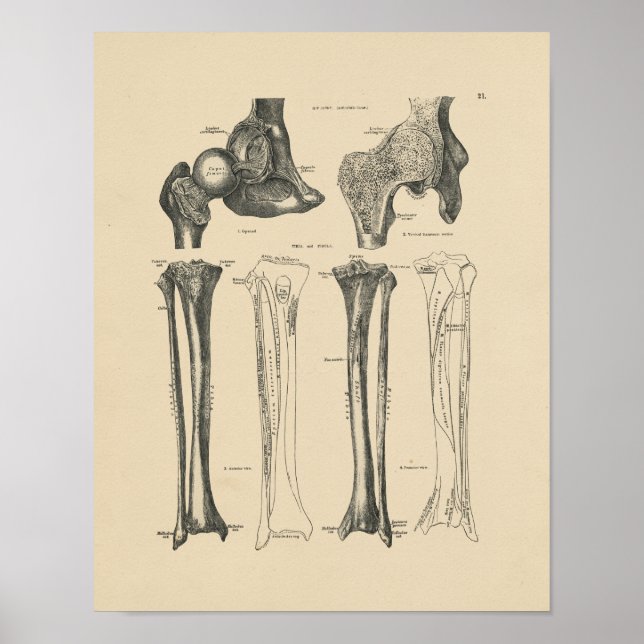 Vintage Hip Joint Anatomy 1880 Print (Front)